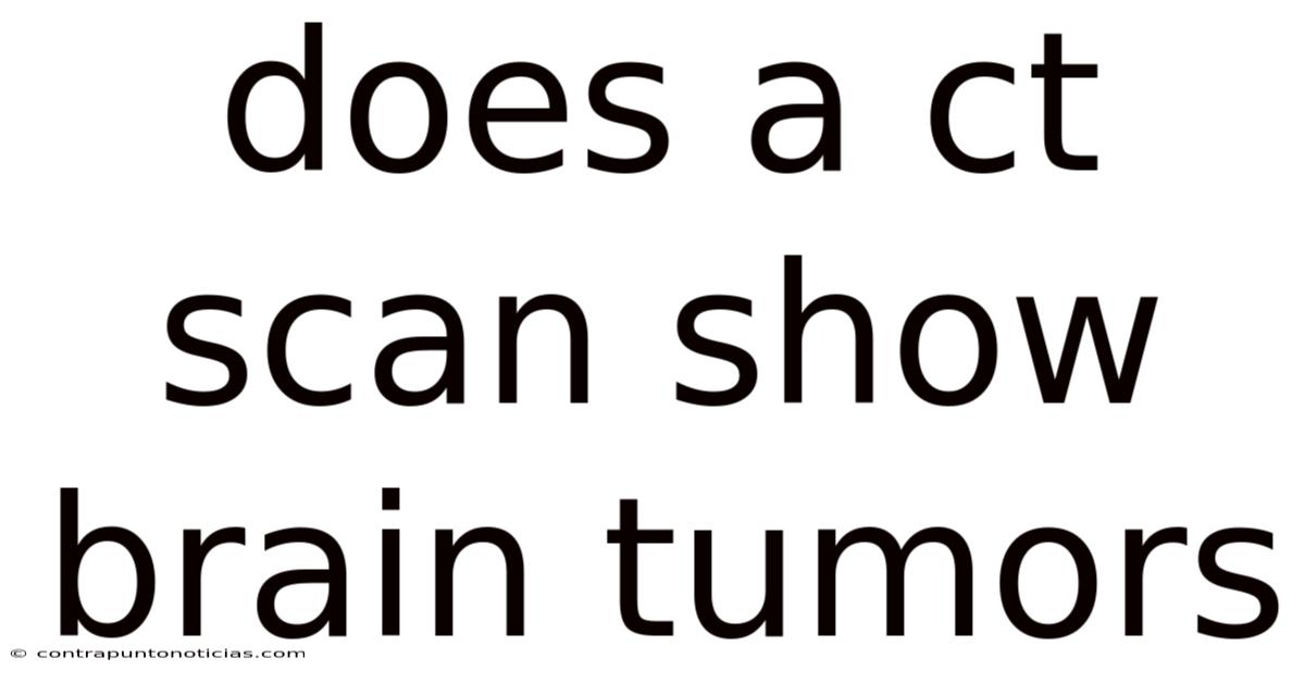 Does A Ct Scan Show Brain Tumors