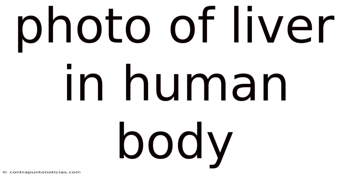 Photo Of Liver In Human Body