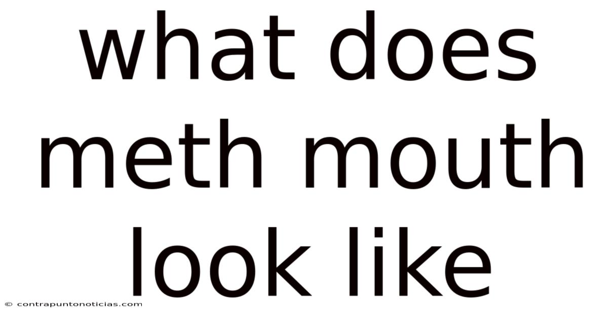 What Does Meth Mouth Look Like
